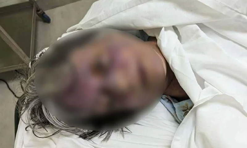  গুলশানে ভারতীয় নারীর রহস্যজনক মৃত্যু: শরীরে আঘাতের চিহ্ন